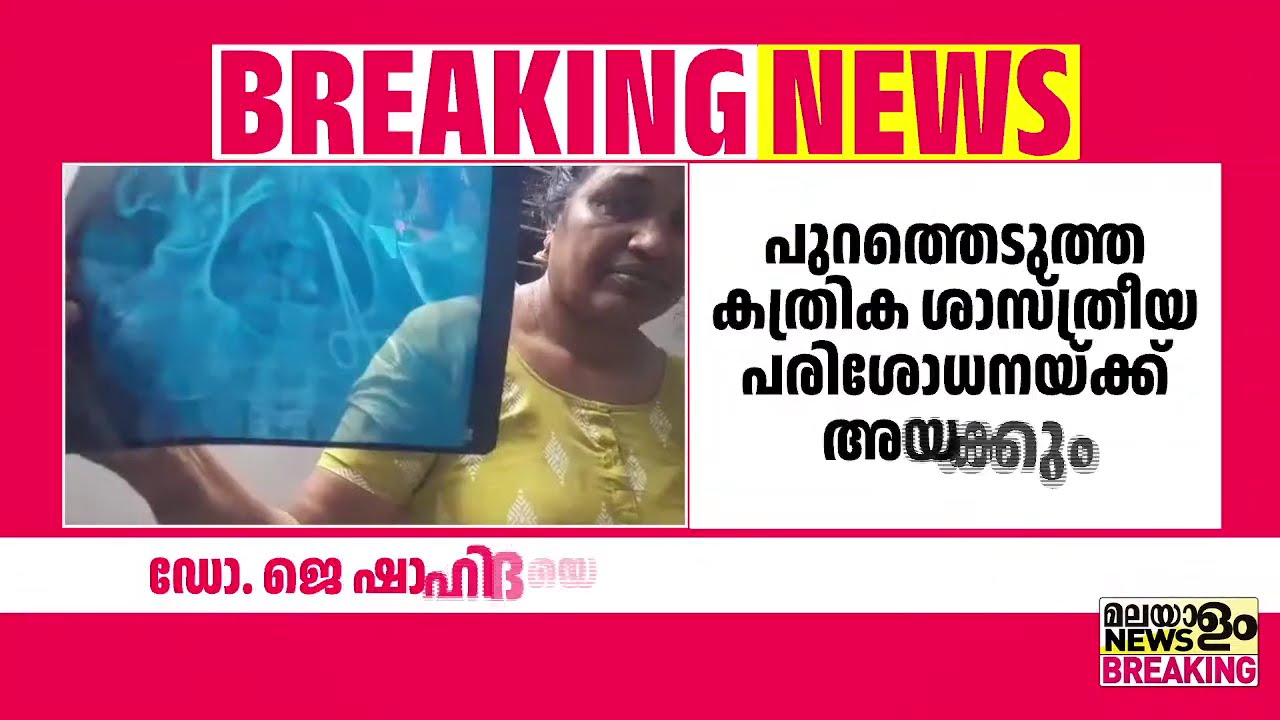 ഡോ.ജെ ഷാഹിദയെ പ്രതിചേർക്കും; വണ്ടാനം മെഡിക്കൽ കോളേജിലെ ചികിത്സാപ്പിഴവ്