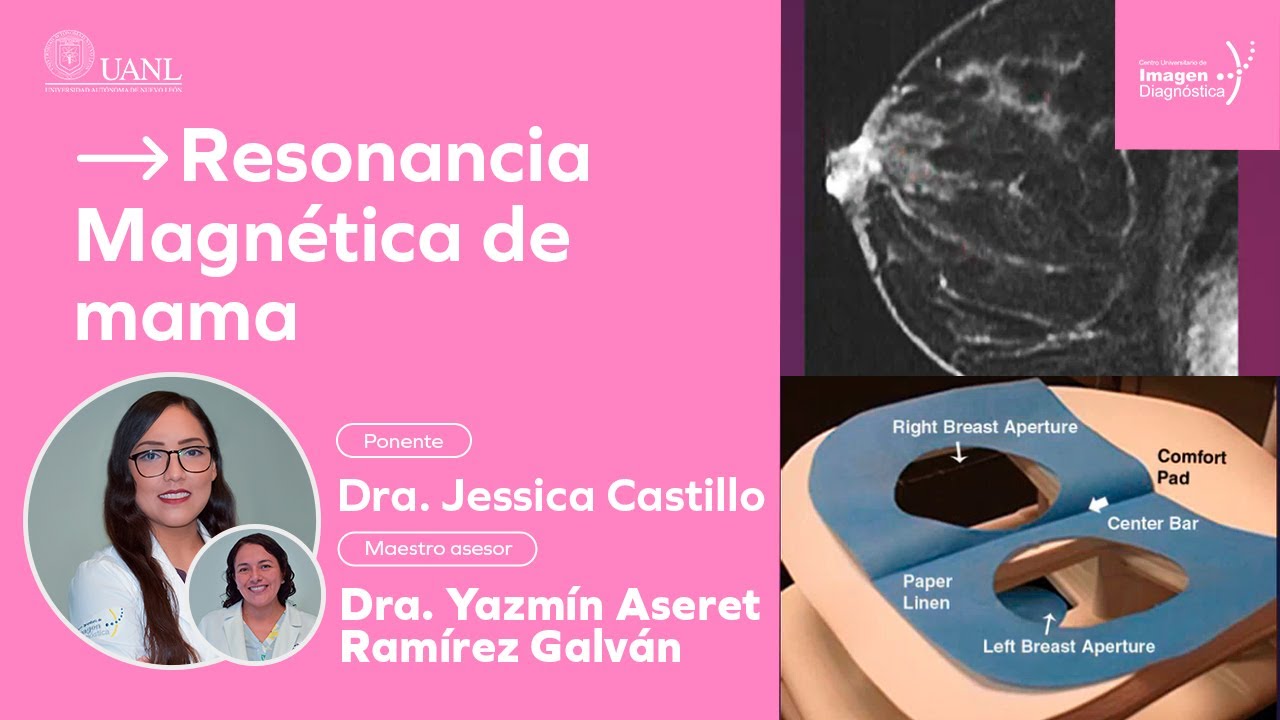 Resonancia Magnética de mama por la Dra. Jessica Castillo.
