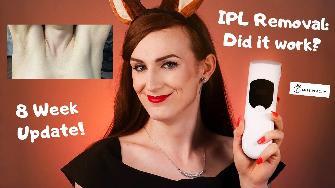 MissPeachy IPL Hair Removal 8 Week Update! Review and Results! | DIMITRIA SPARROW