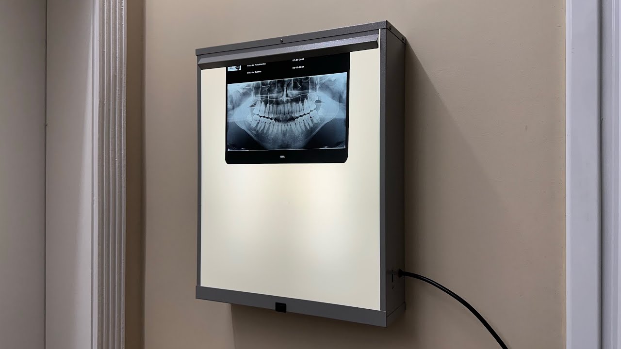 Negatoscópio fluorescente 2x15W reator convencional - Manutenção completa