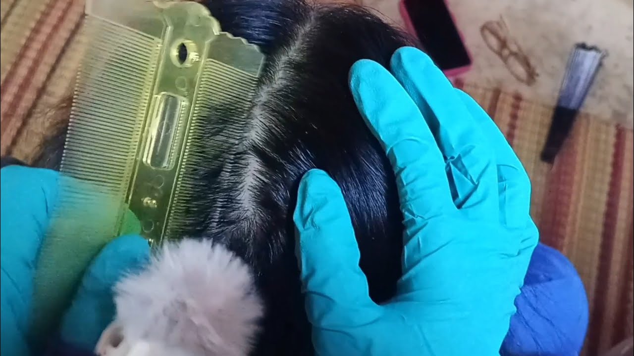 ASMR: Dandruff Removal Scratching Sounds
