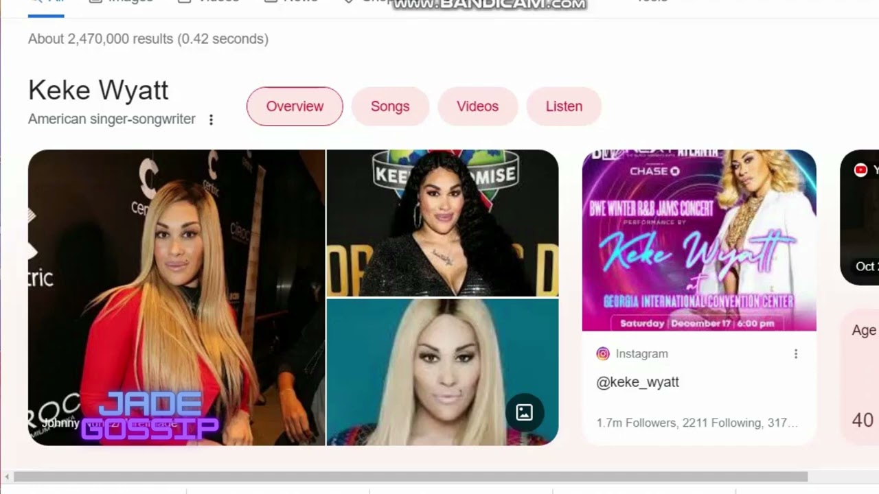 Exclusive Look at Keke Wyatt's Botched Brazilian Butt Lift Procedure