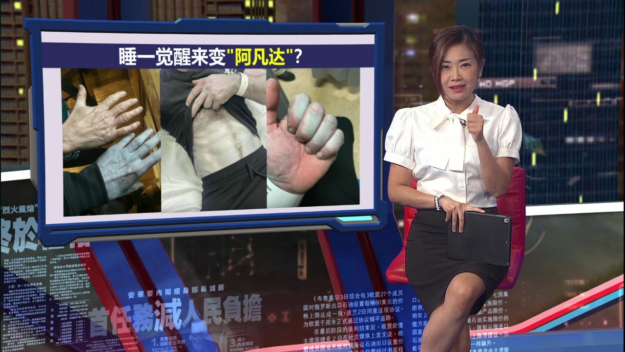 睡一觉醒来变“阿凡达”？ 男子身体变蓝紧急送院 | 新闻报报看 13/03/2026