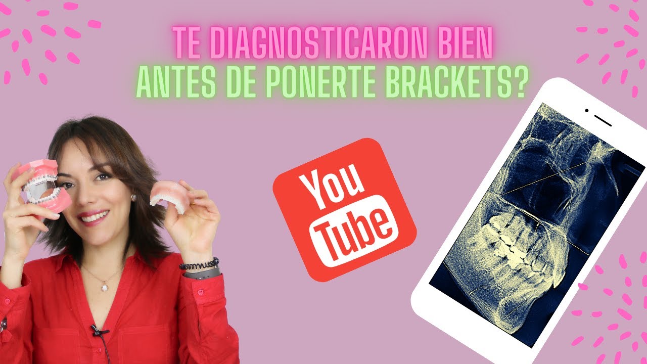 TU diagnóstico de ORTODONCIA está BIEN hecho? - Te explico cómo lo HAGO