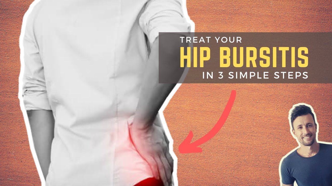 Successfully Treat Your Hip Bursitis in 3 Simple Steps