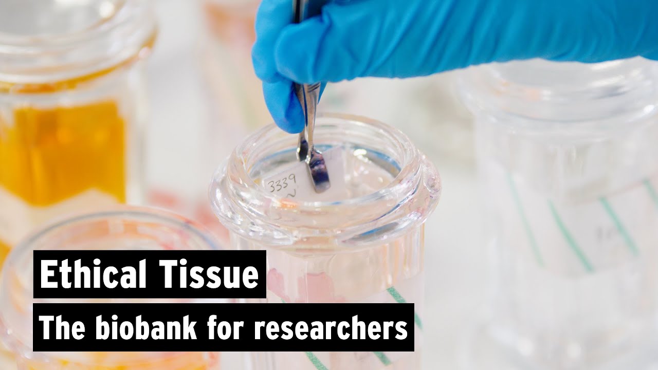 Ethical Tissue | The biobank for researchers