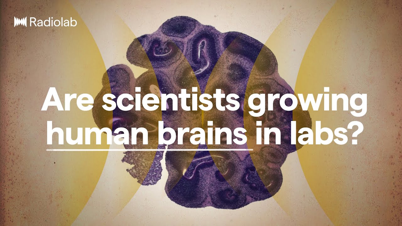 Brain Balls | Radiolab Podcast