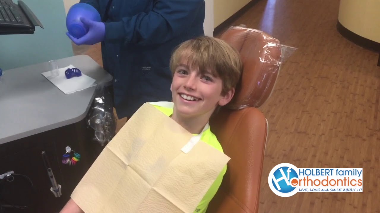 Traditional Impressions with Holbert Family Orthodontics in Richmond and New Kent