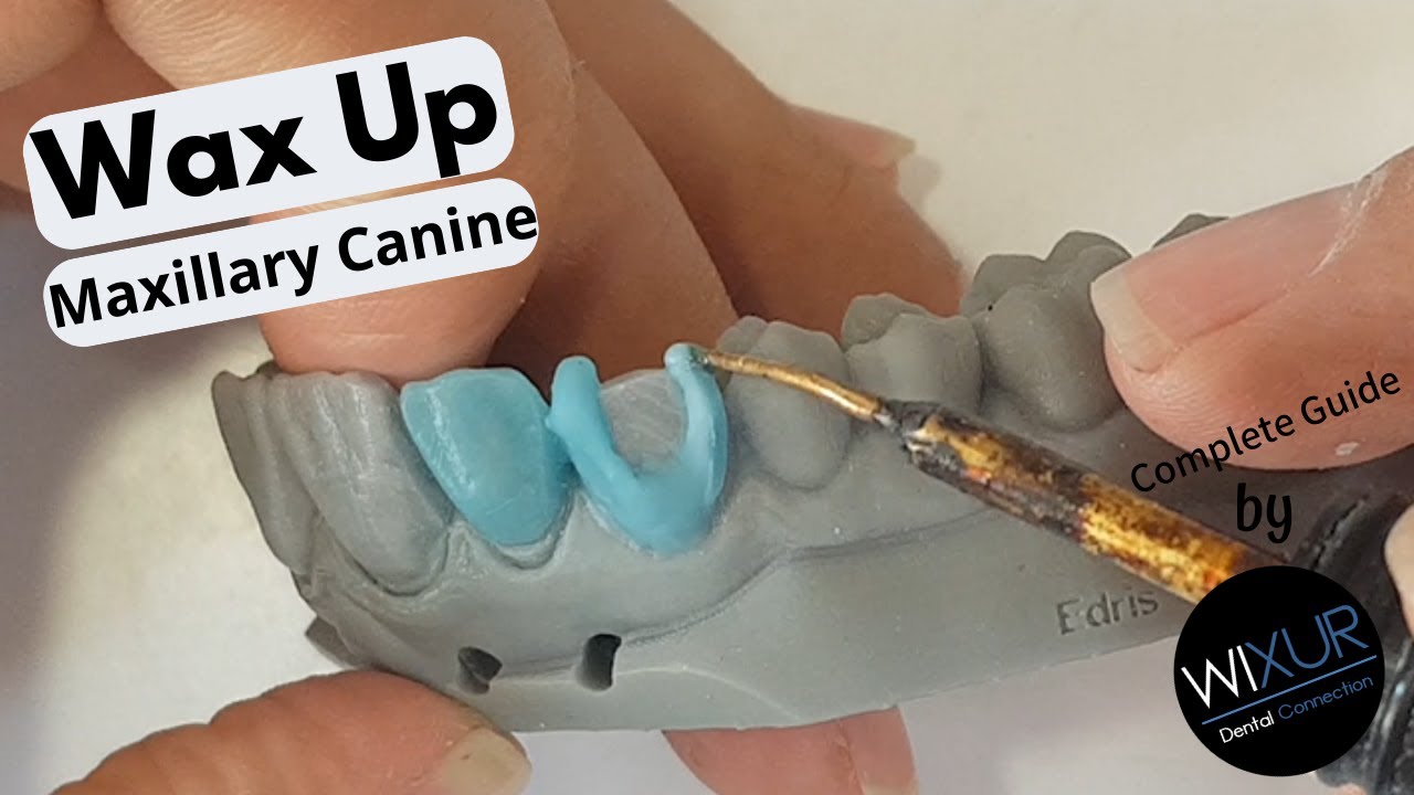 Live Wax Up - Upper Canine (HD)