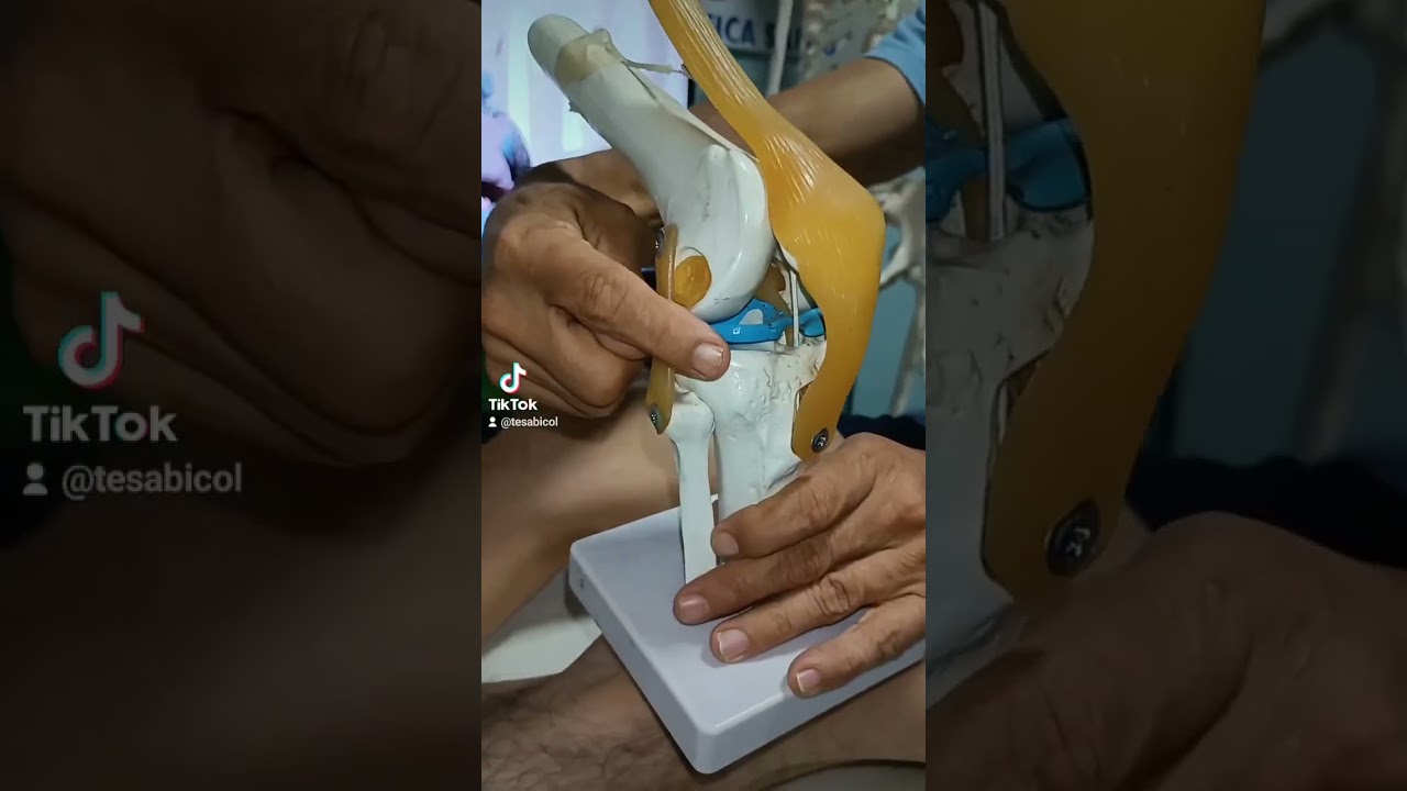 c&oacute;mo identificar dolor en el menisco.