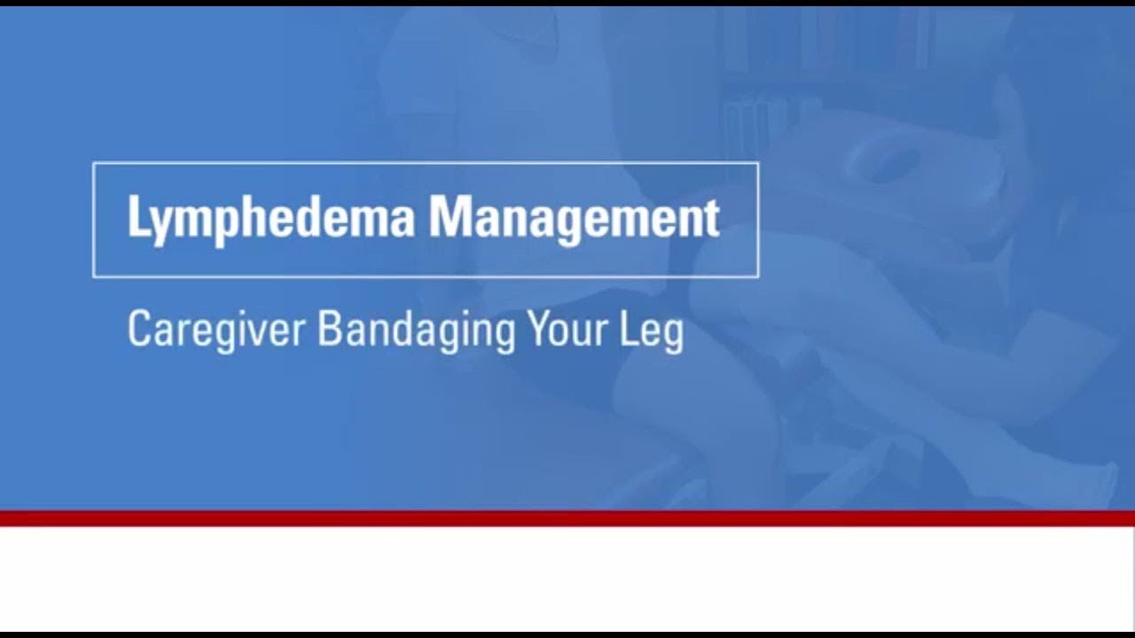 Lymphedema management: Caregiver bandaging your leg
