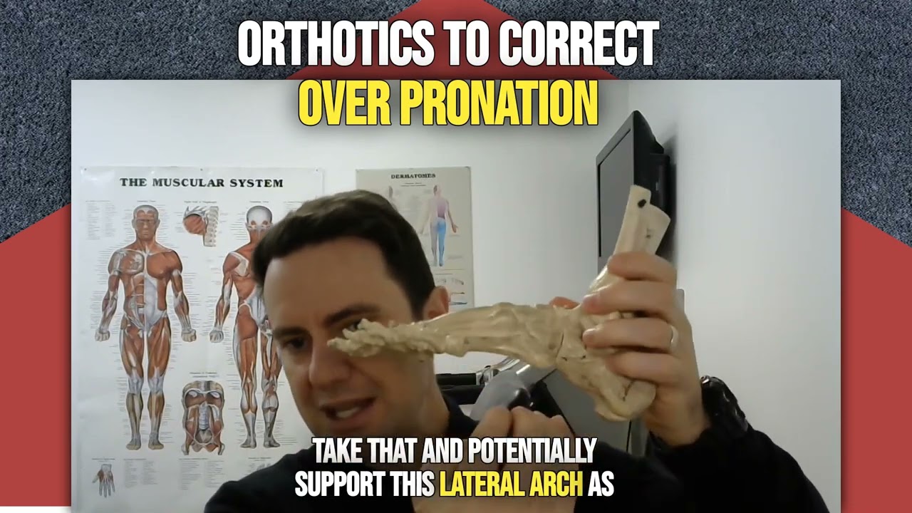 Orthotics To Correct OverPronation