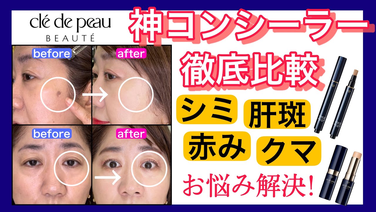 【シミ•肝斑•赤み•クマ】クレドポーボーテの神コンシーラーであなたの悩み解決します！