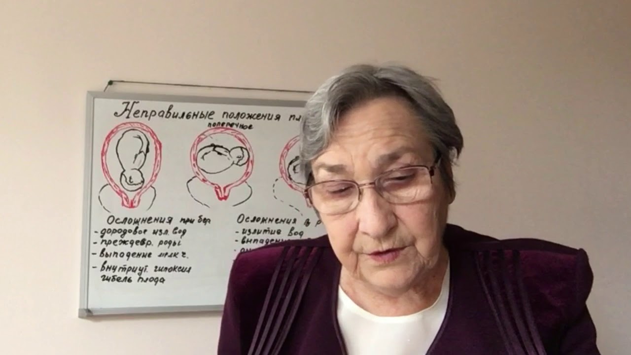 Неправильные положения плода (67)