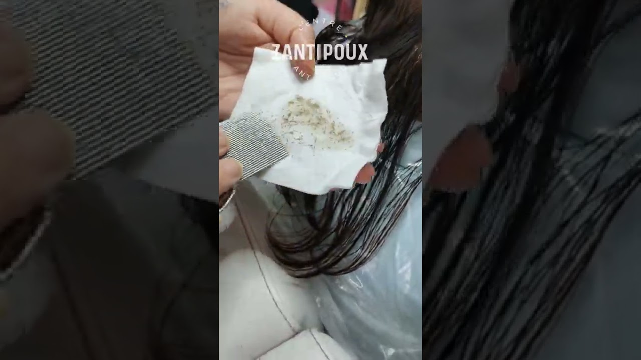 Élimination des lentes et poux en centre anti-poux chez Zantipoux