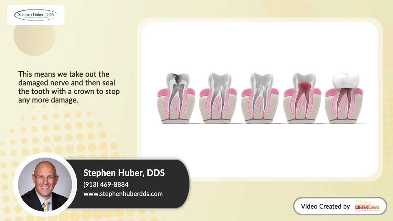 Can You Save a Broken Tooth? Dentist's Guide