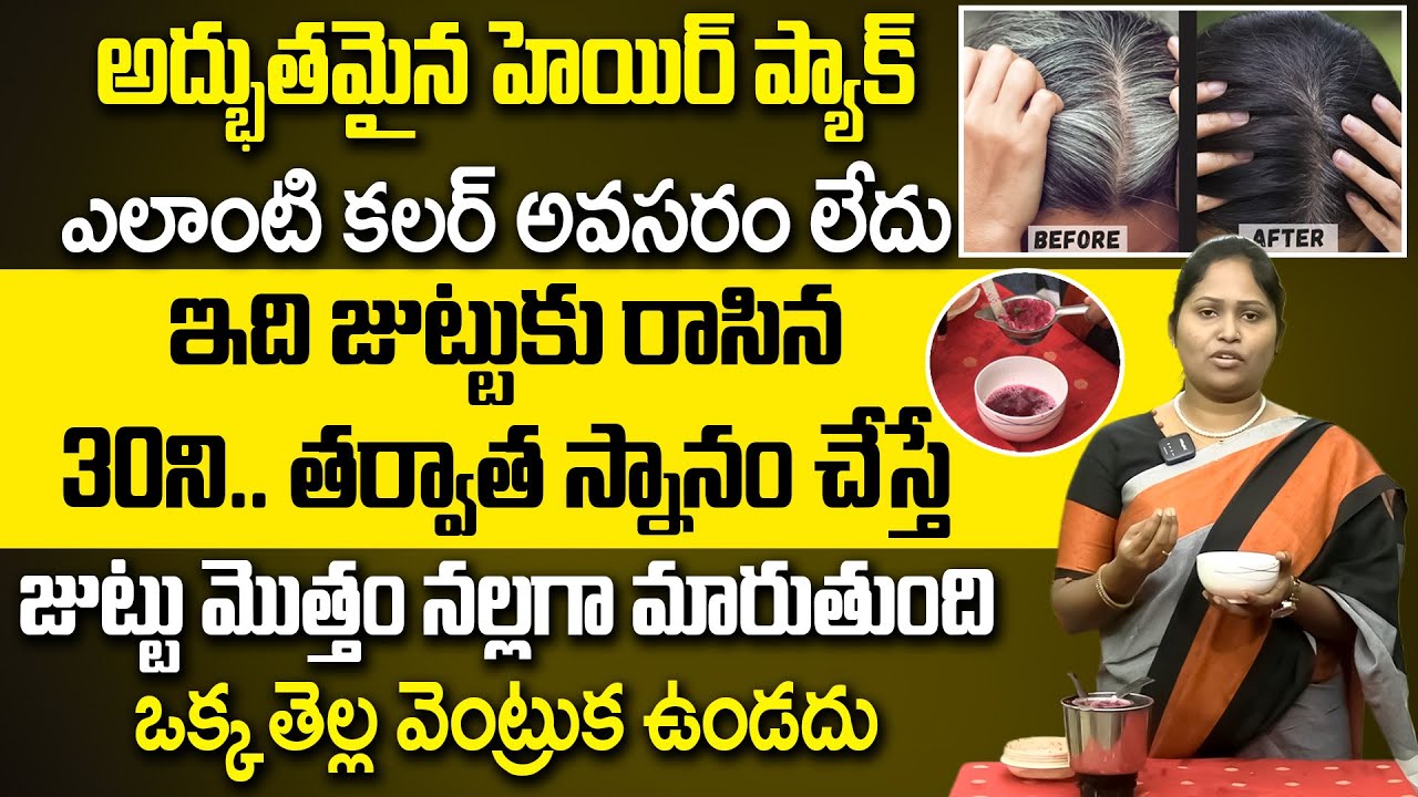 Dr Shagufta - Get Rid of Gray Hair Easily | Best Home Remedy For Premature Greying Hair | | iDream