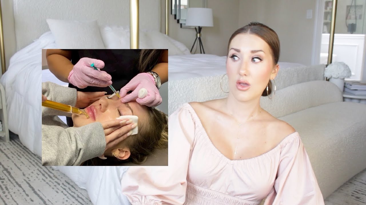 WATCH ME GET MY LIPS DONE! (& BOTOX) NEW HERMES, SALE, AND MORE