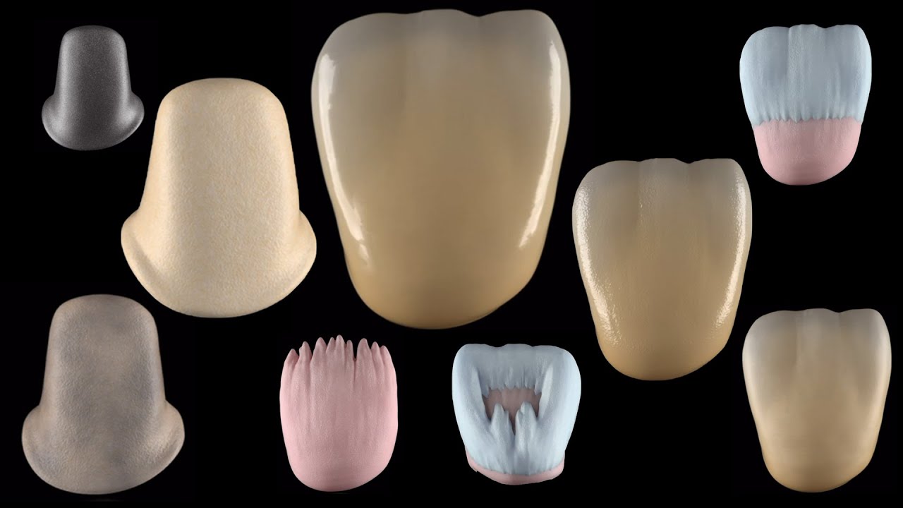 التاج الخزفي المعدني من الألف إلى الياء  pfm ( porcelain fused to metal )