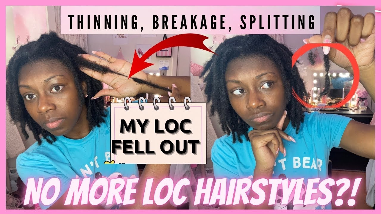1 Year Instant Loc Journey Update | Loc Breakage, Thinning, Falling out (No more tight Hairstyles)