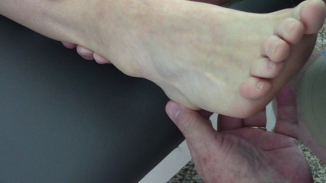 Ankle Laxity Visualized