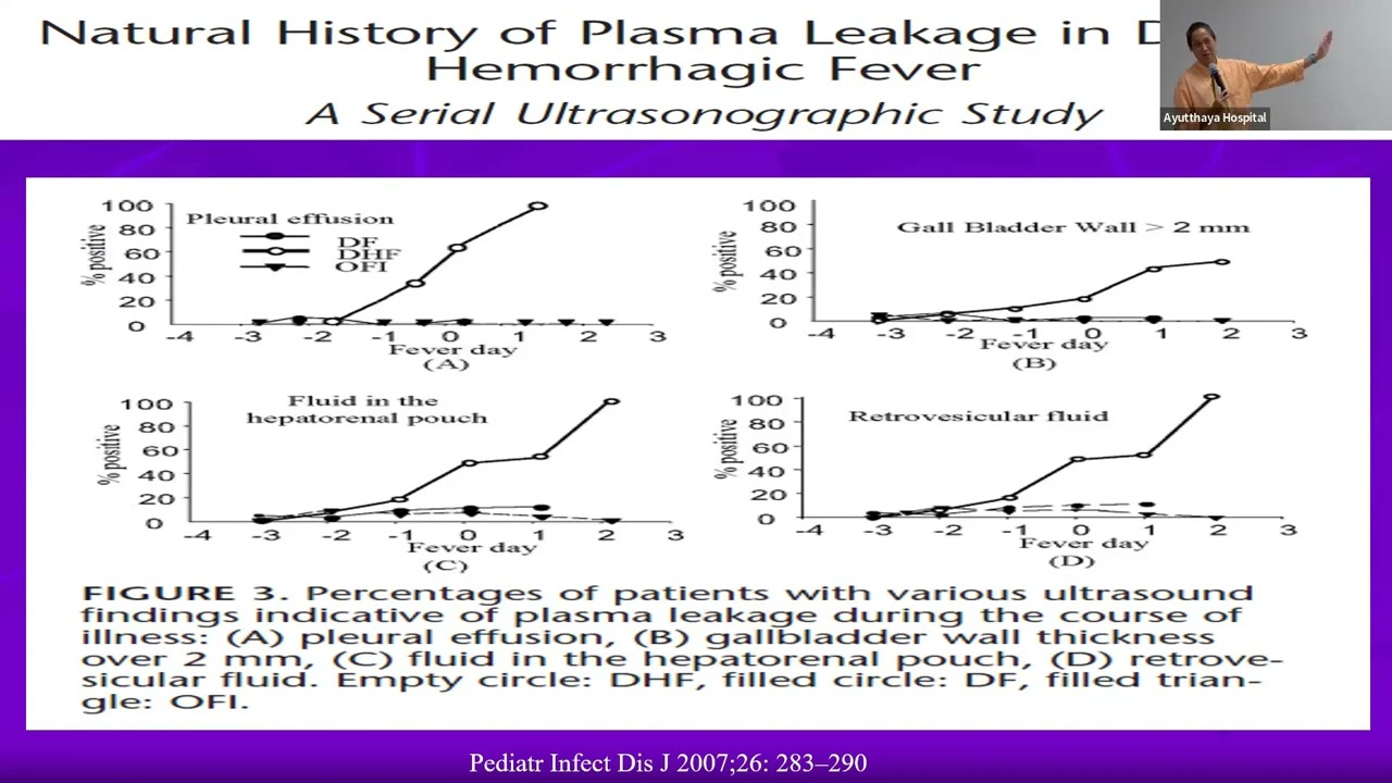 Update in management of Dengue Shock Syndrome - 17082023