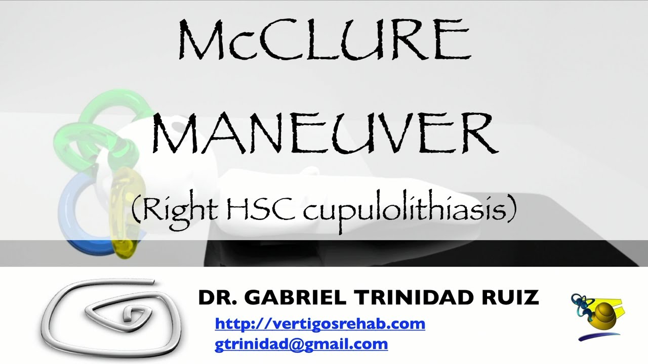 McCLURE MANEUVER RIGHT HSC CUPULOLITHIASIS