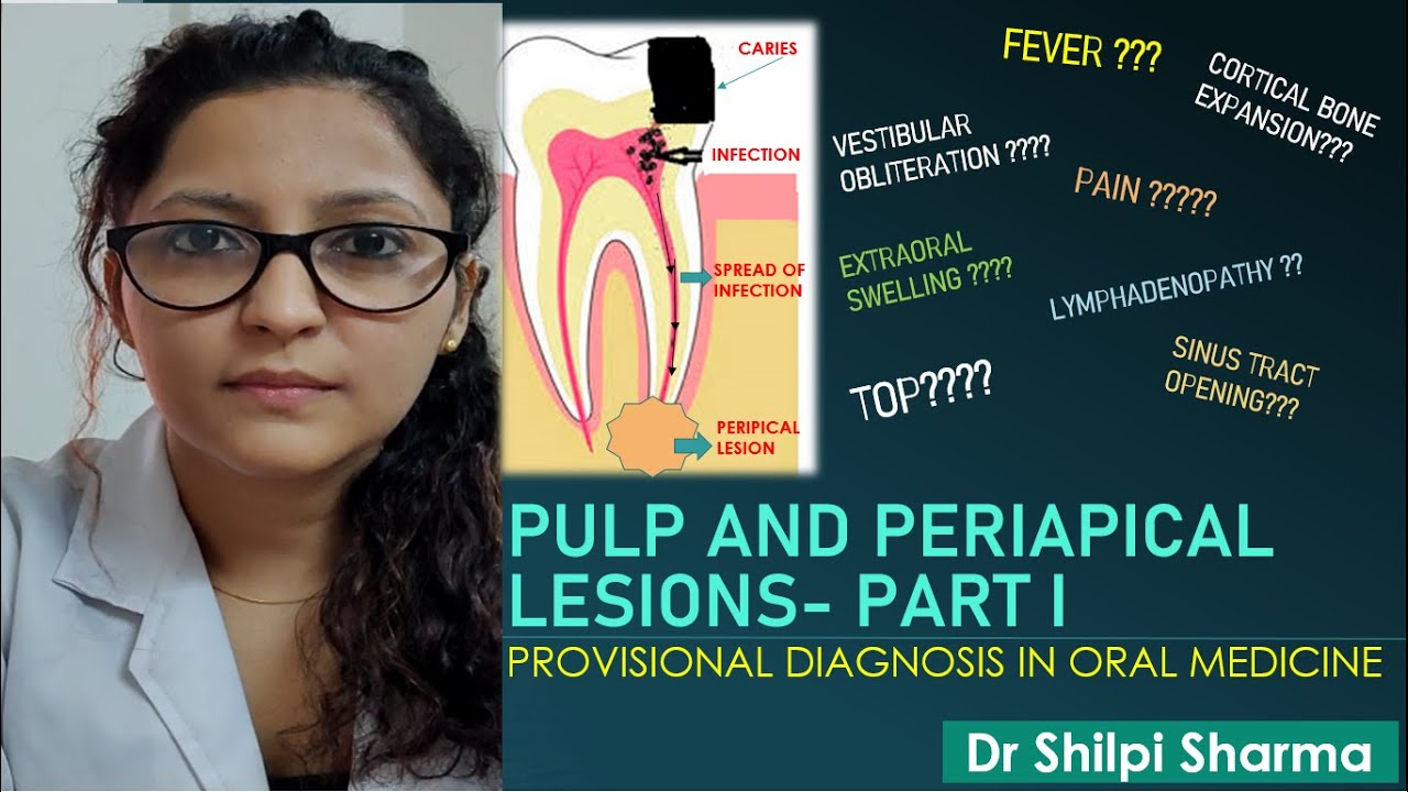 Pulp and periapical lesions - Part I (in Hindi)। Chairside Diagnosis