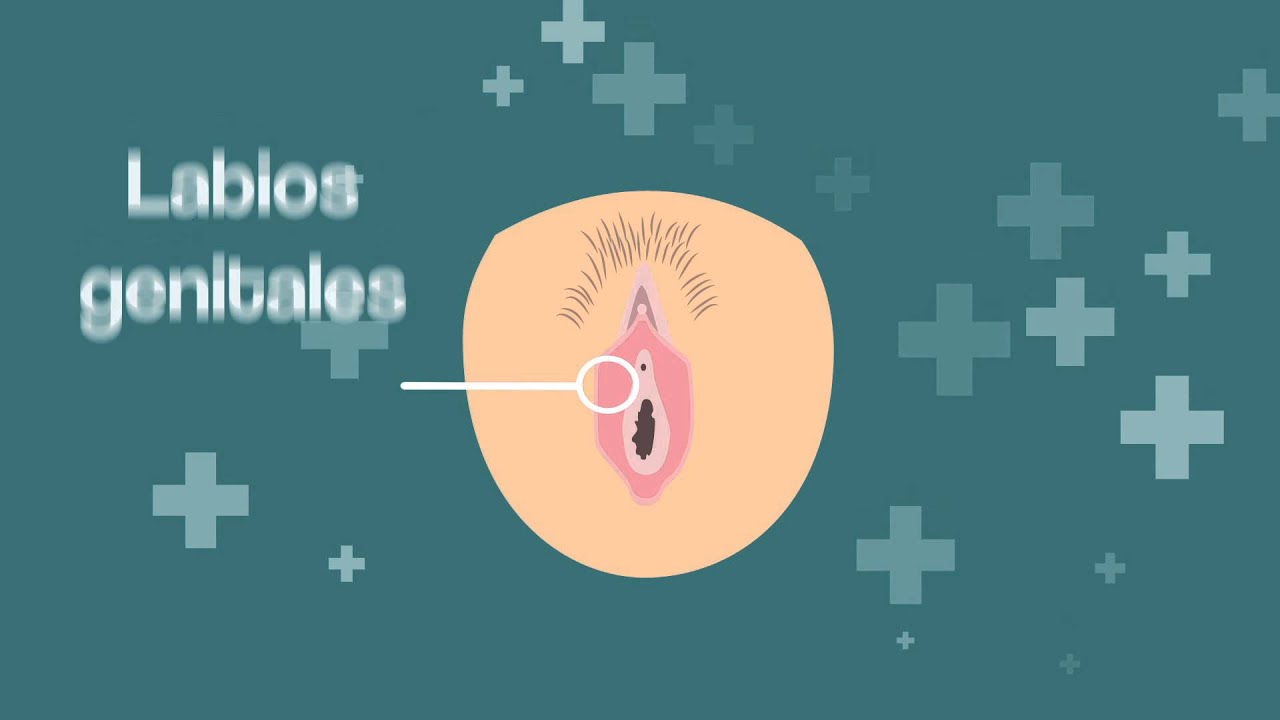 C&aacute;nceres Ginecol&oacute;gicos