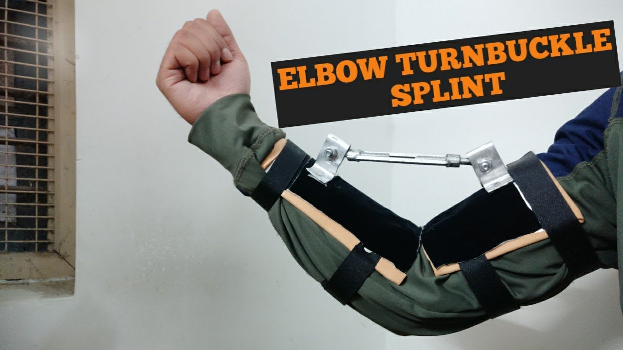 Elbow Turnbuckle Splint For Elbow Contracture.
