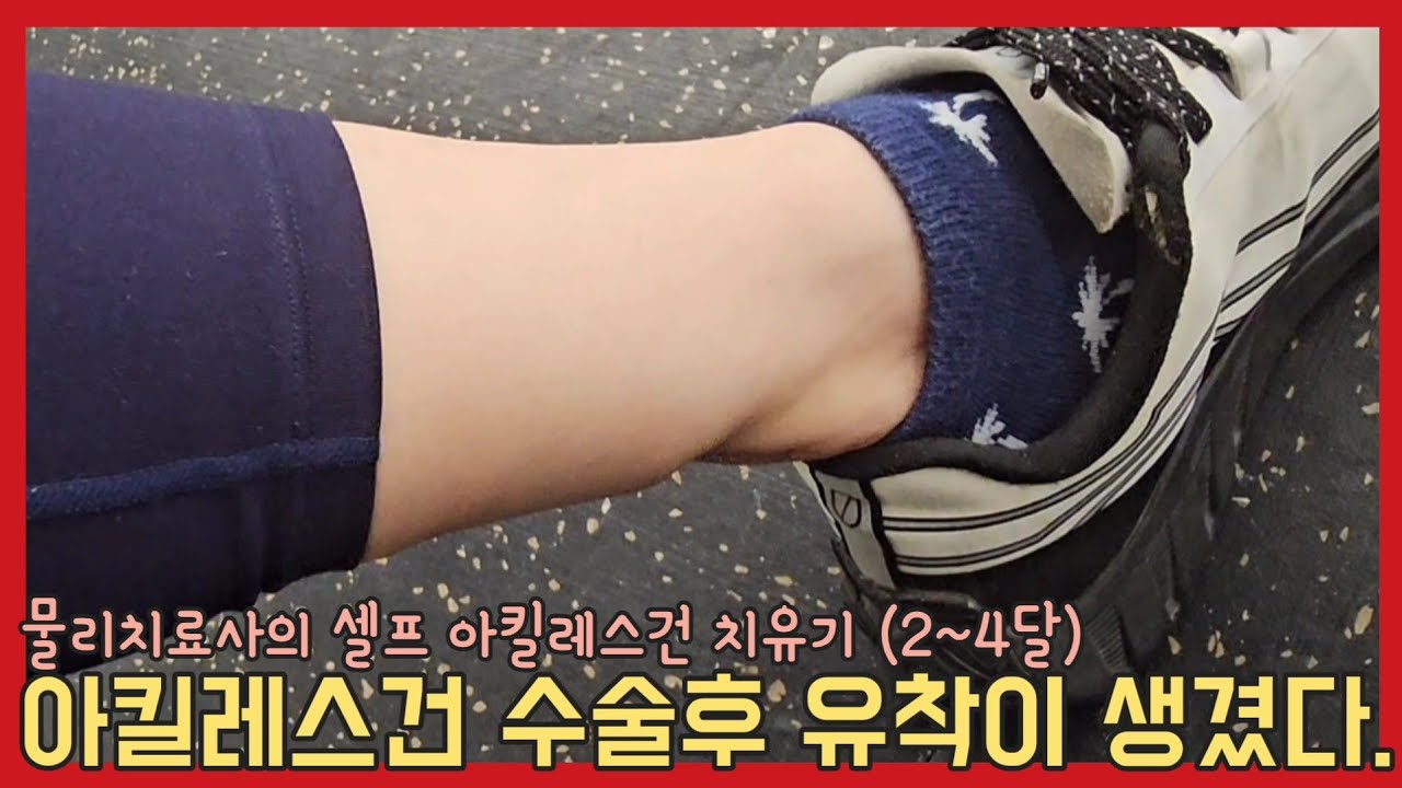아킬레스건 파열 수술 재활 (2~4달차)