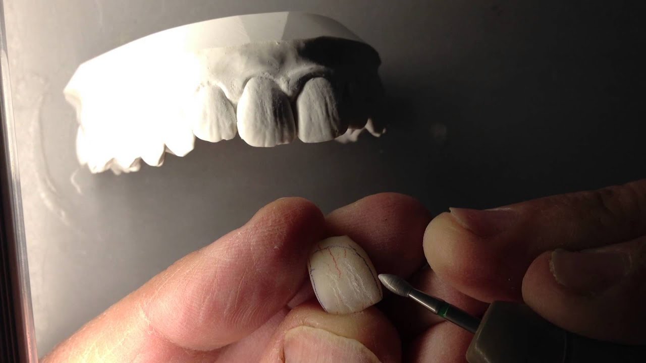 Gérald Ubassy light for studying surface texture.