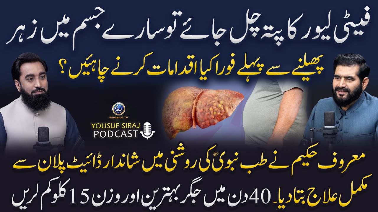 Fatty Liver ka Ilaj | Zehar Phelne se Pehle Fauri Ye Kar Lein! | 40 Din mein Jigar Behtareen