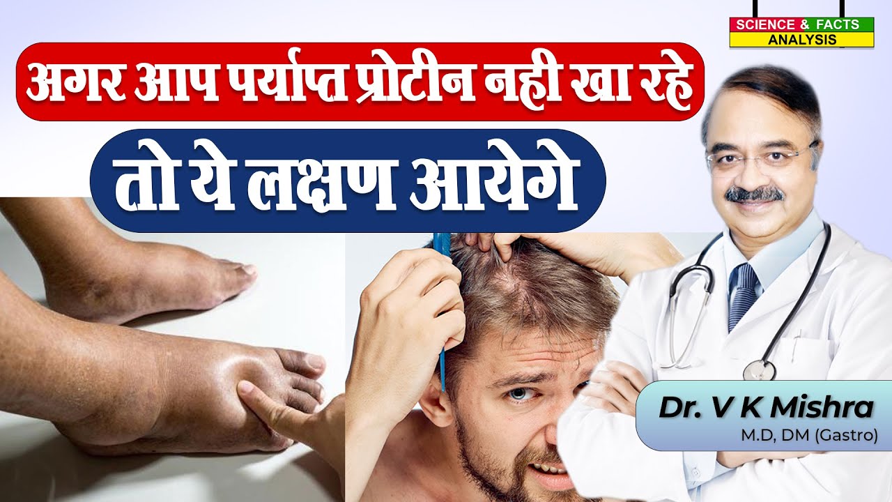 अगर आप पर्याप्त प्रोटीन नहीं खा रहे तो ये लक्षण आयेगे || SIGNS YOU ARE NOT GETTING ENOUGH PROTEIN