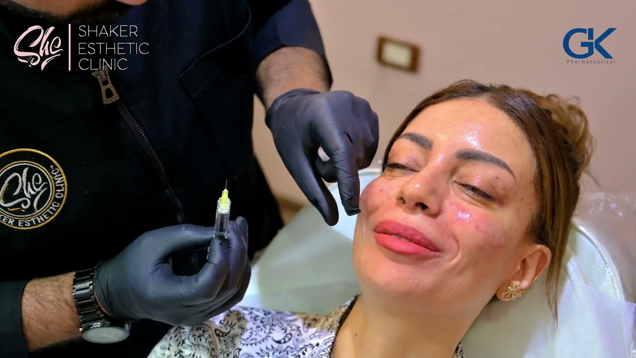 نتيجة ابرة النضارة Xela لعلاج الهالات السودا