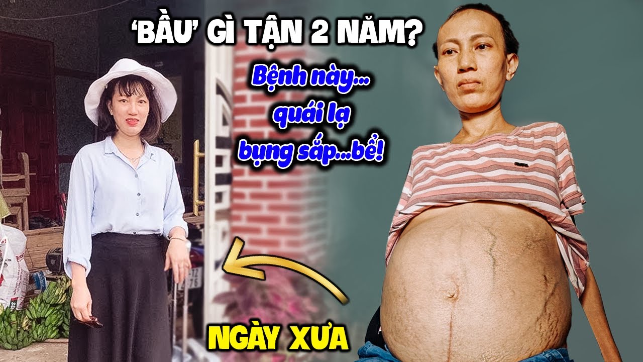 🍏 Quái lạ: Không có tử cung mà 'bầu' 2 năm? Đời mẹ đơn thân bi đát khó tin