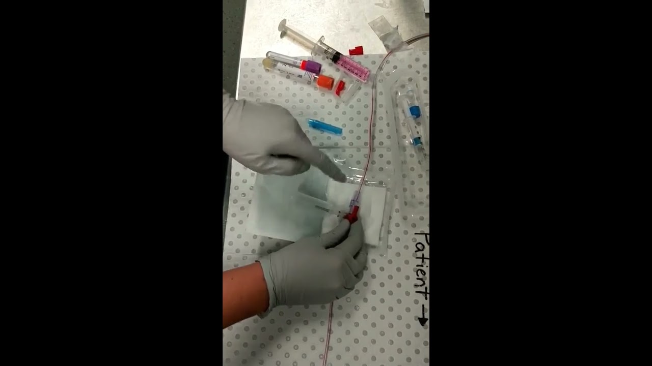 Arterial Line Blood Collection