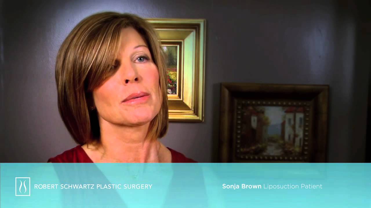 Vaser&reg; Liposuction Expert | Dr. Robert Schwartz