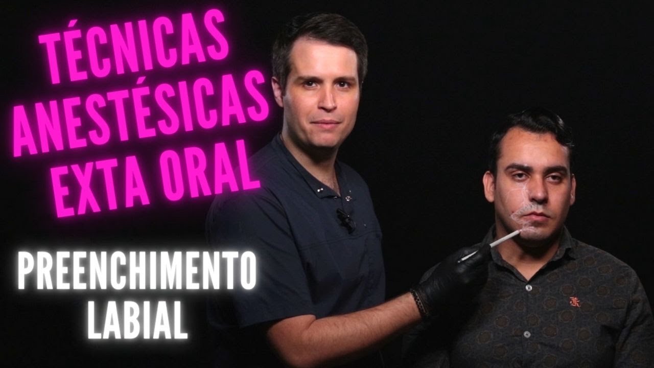 Anestesia Extra Oral - Demonstração Da Anestesia Extra Oral
