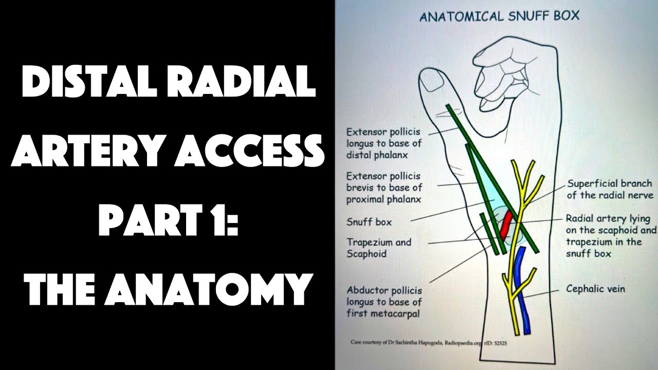 Distal Radial Artery Access Part 1: The Anatomy