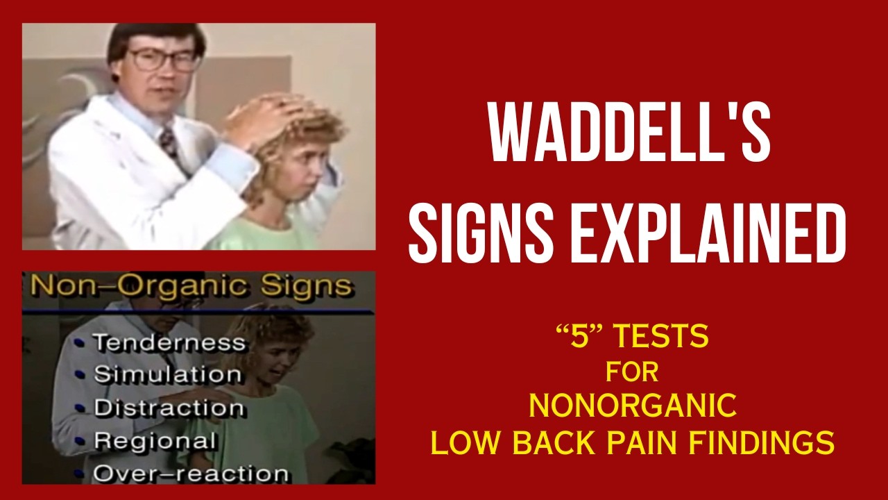 Waddell's Signs - A Screening Tool for Nonorganic Physical Findings