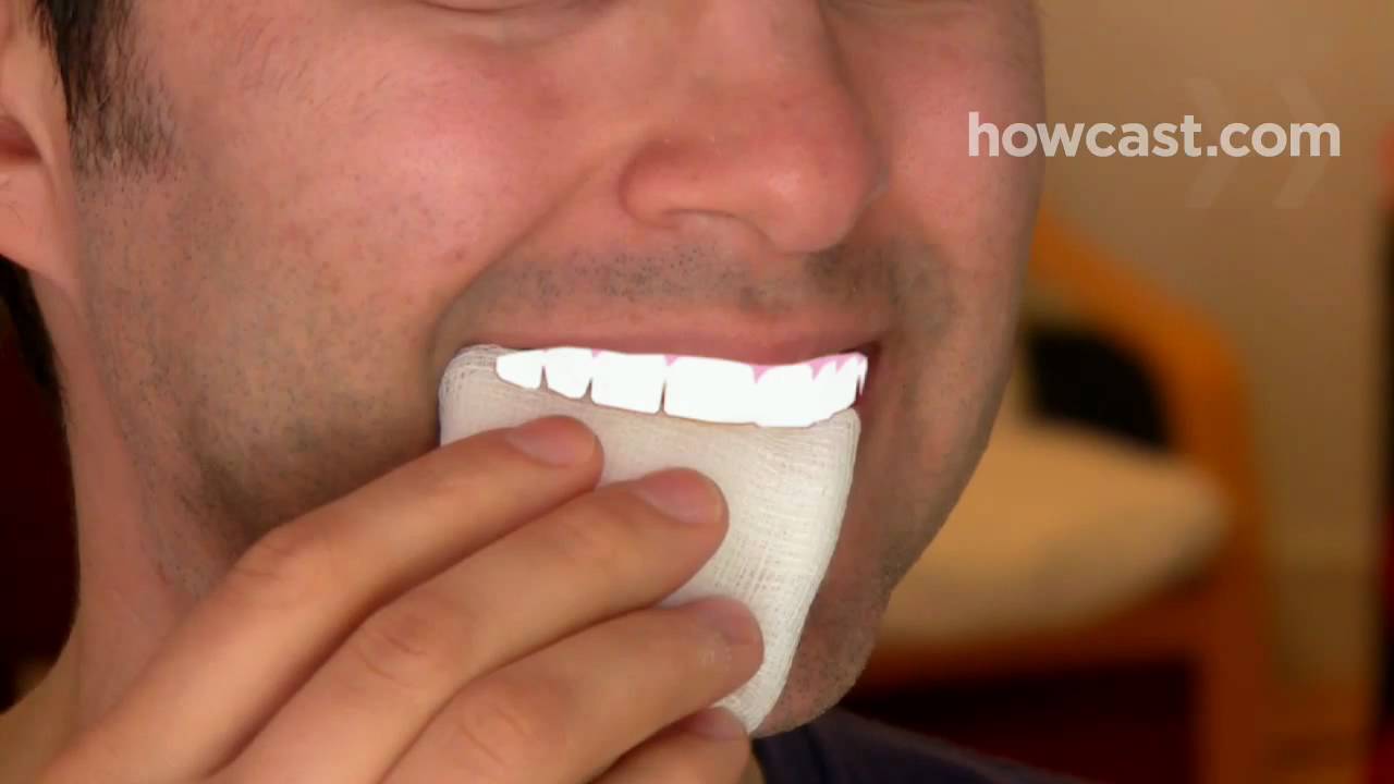 How to Deal with a Knocked-Out Tooth