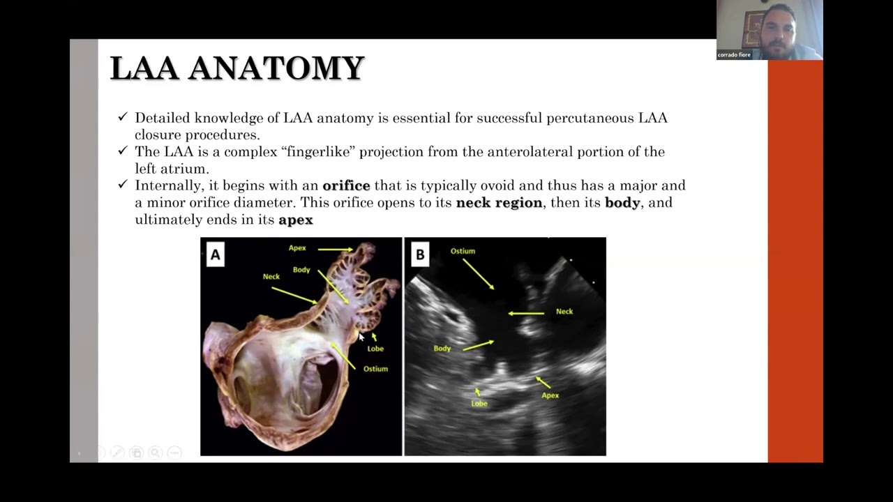 ECOCARDIOGRAMMA TRANSOFAGEODURANTE PROCEDURE INTERVENTISTICHE