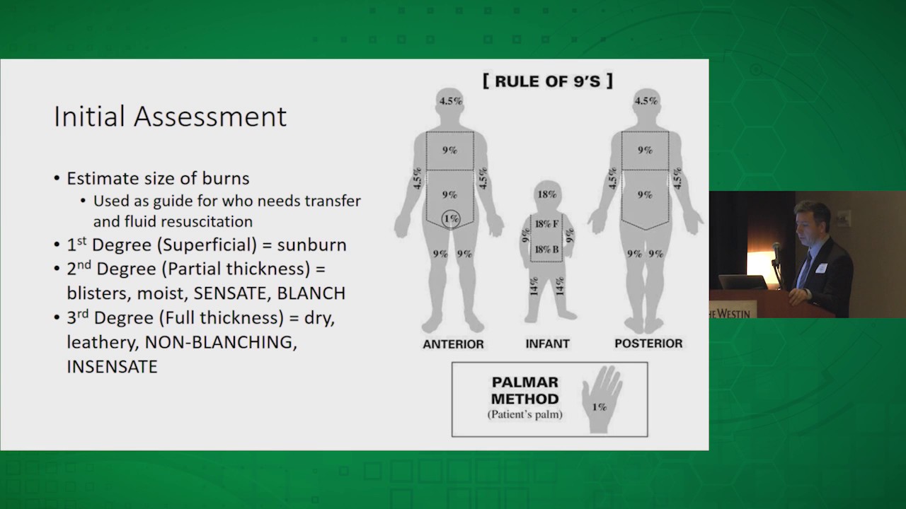 Initial Burn Management