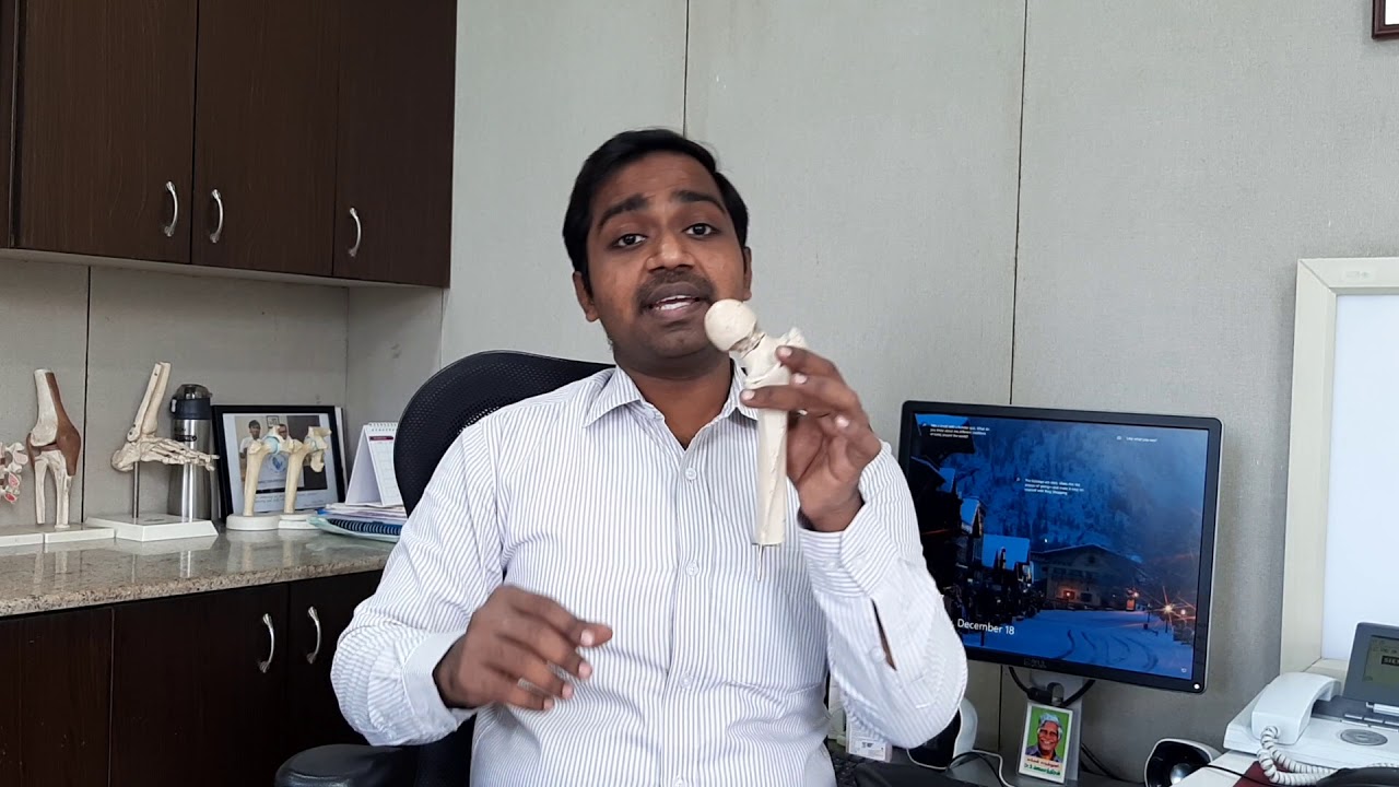 இடுப்பு எலும்பு முறிவு மற்றும் அதன் தீர்வு