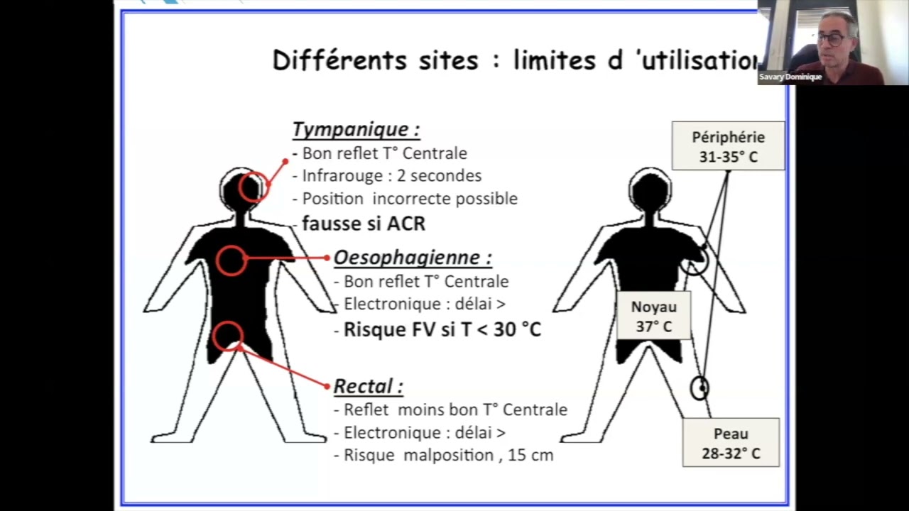 Hypothermie (Socle) - D. Savary