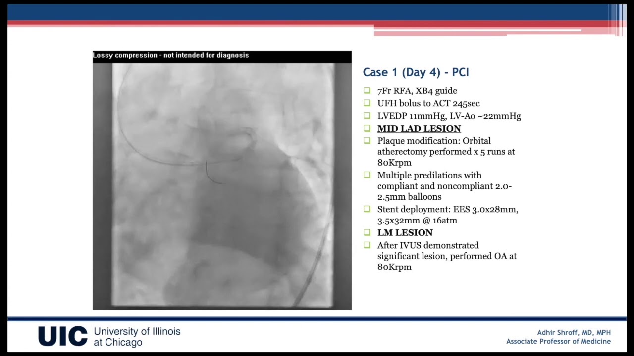 CVI 2020_0711_0315_COVID-19 and its impact on Cardiovascular Practice