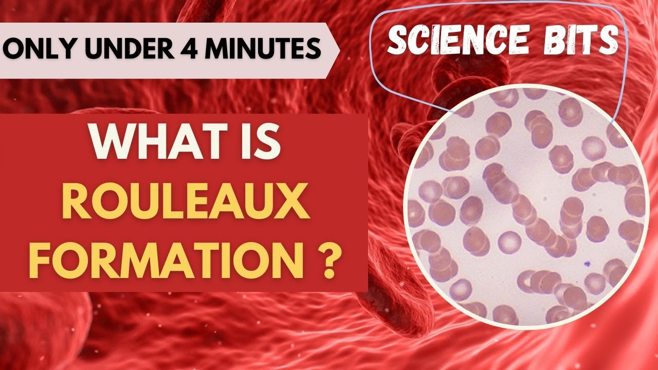 Science Bits: What is Rouleaux formation? | Under 4 Minutes