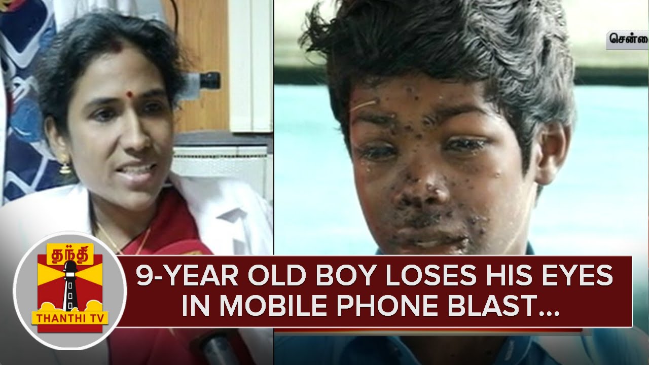 9-Year Old Boy Loses his Vision in Mobile Phone Blast while Charging - Thanthi TV