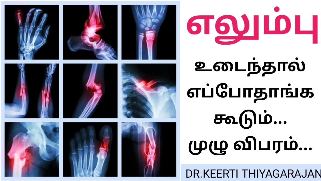 FRACTURE HEALING PART - 2 / எலும்பு உடைஞ்சா எப்பத்தாங்க கூடும் - முழு விவரம் #fracture
